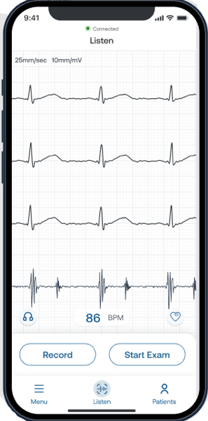 Eko_App_Listen_with_Frame.png