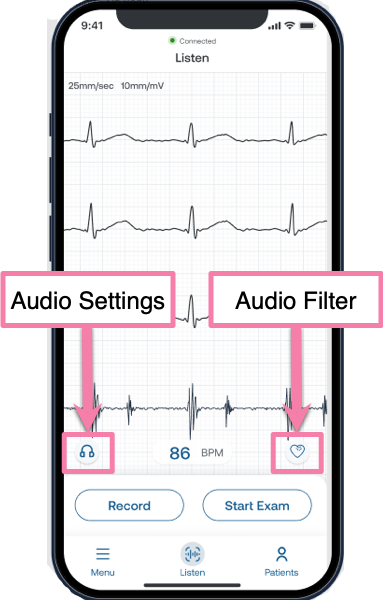 Eko_App_Listen_Audio_Settings_and_Filters.png