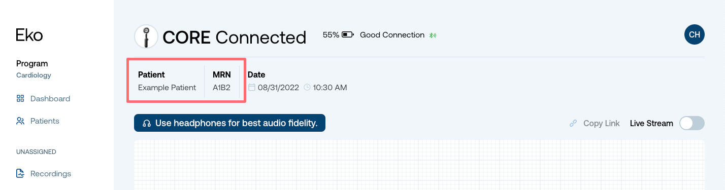 Recording_from_patient_profile_3.png