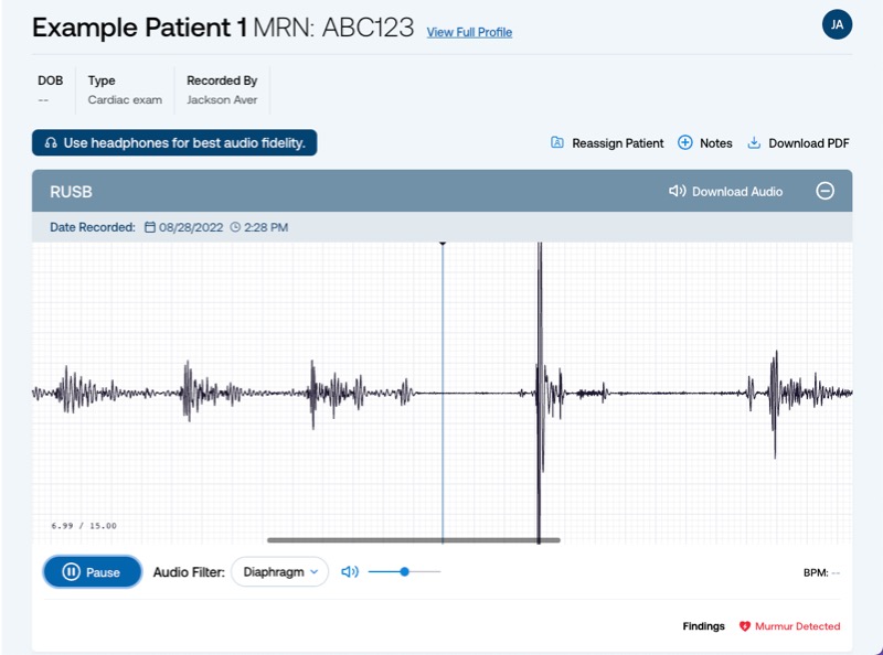 Patient_recording.jpg
