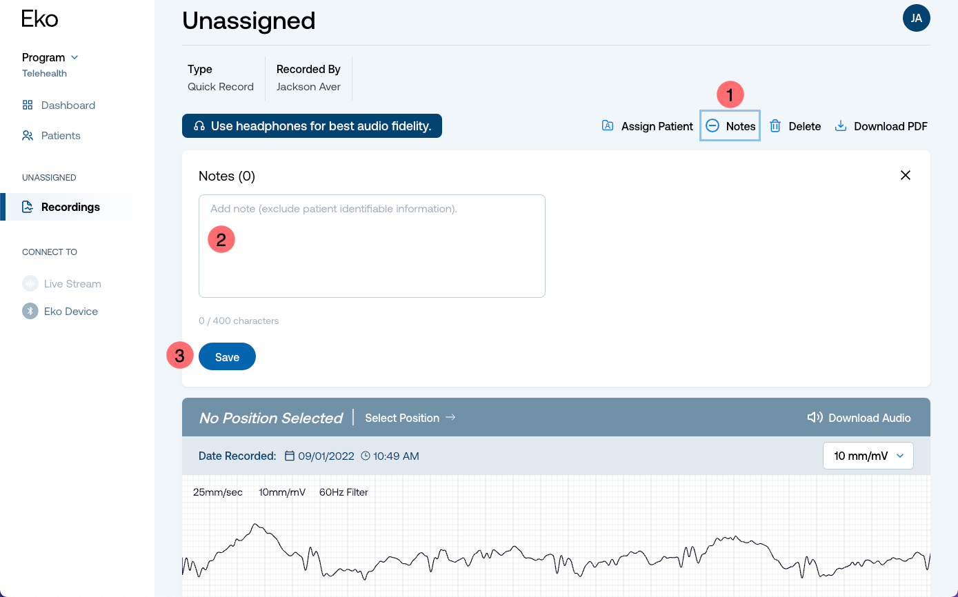 Unassigned_recordings_notes.png