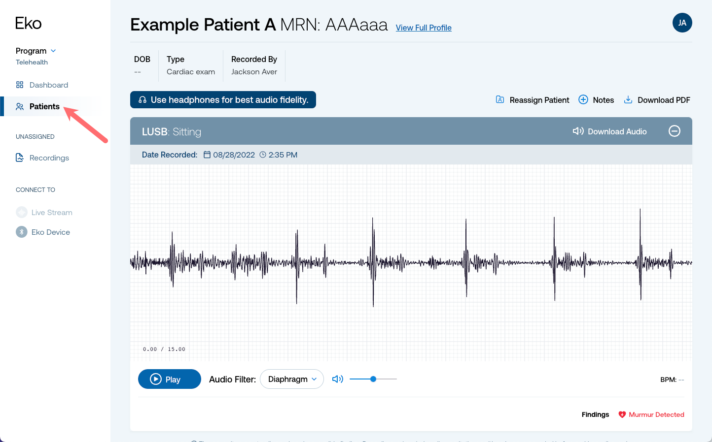 Unassigned_recordings_assign_4.png
