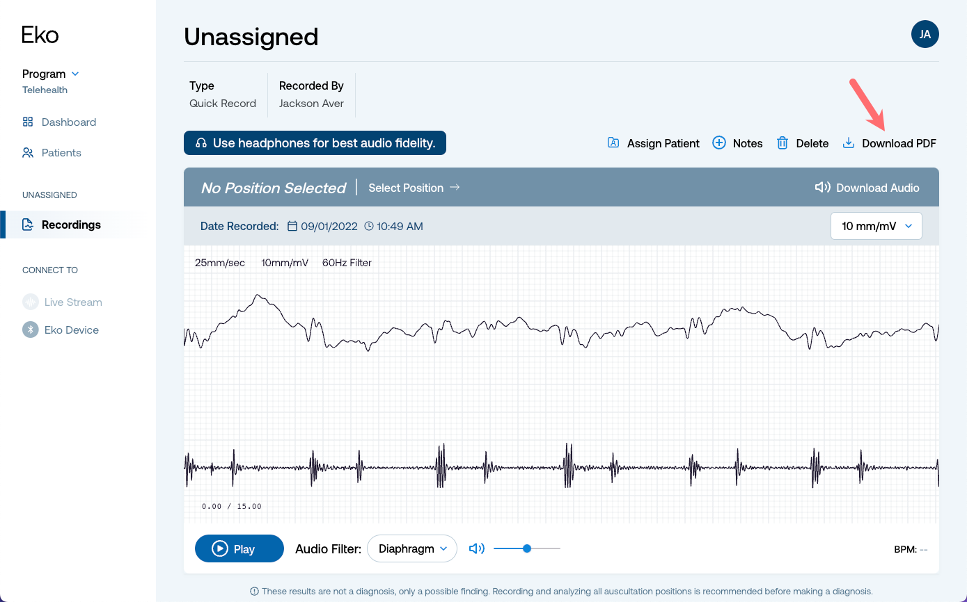 Unassigned_recordings_download.png