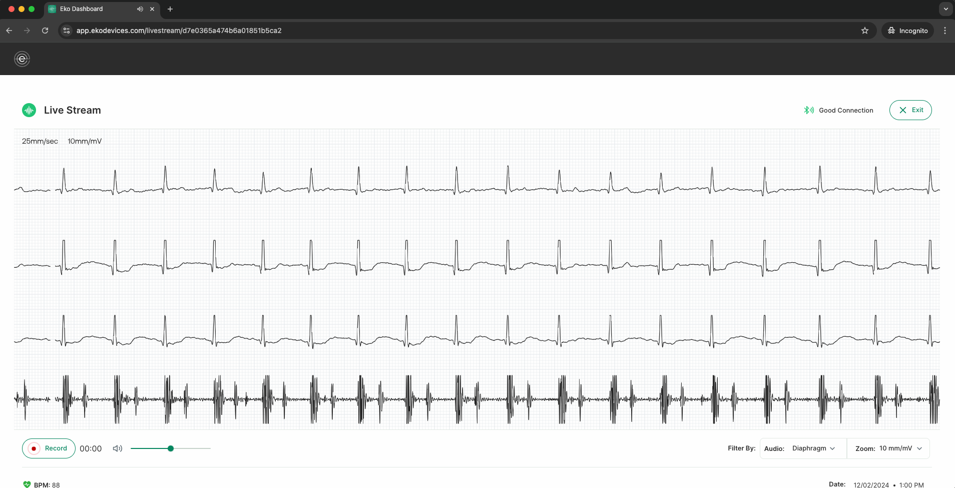 Screenshot 2024-12-02 at 1.00.57 PM (2).png