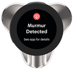 CORE_500_Analysis_Murmur.png